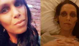 Mới 32 tuổi đã chết vì ung thư ruột: BS lưu ý đi vệ sinh có dấu hiệu này phải khám ngay