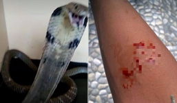 Đăng ảnh bị rắn hổ mang cắn, cậu bé không ngờ bi kịch xảy ra ngay sau đó 