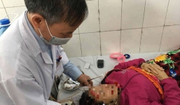 Hà Nội: Lạnh kéo dài, ngày nào cũng có vài chục bệnh nhân nhập viện vì méo mồm, liệt mặt