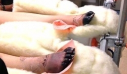 Từ một người mẫu xinh đẹp, tràn trề nhựa sống, cô gái này phải cắt bỏ một chân vì món đồ rất nhiều chị em đang dùng