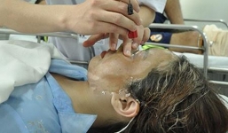 Gã đàn ông tạt axit tình cũ vì quen biết với người khác