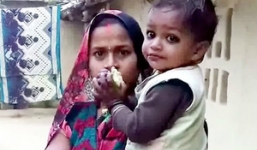 Cậu bé được người dân tôn thờ vì mọc đuôi ở lưng