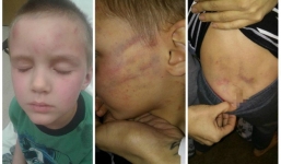 Bé trai 5 tuổi bị bạn trai của mẹ bạo hành dã man vì mở quà Giáng sinh sớm