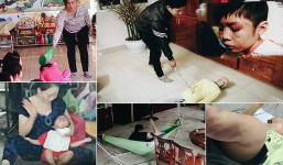 9 vụ bạo hành trẻ em gây chấn động năm 2017