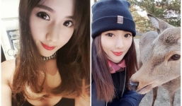 Người mẫu 28 tuổi qua đời do xuất huyết não khi đang hát karaoke