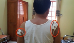 Khởi tố trưởng công an xã dùng súng bắn chủ tịch xã