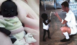 Những đứa trẻ kỳ lạ khiến bạn không thể tin các bé đang tồn tại trên Trái Đất