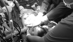 Ngã vào chén cơm vỡ, bé gái 2 tuổi bị mảnh sứ cứa cổ nguy kịch