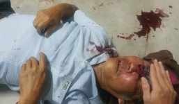 Bắt bảo vệ chung cư đánh nhà thơ gần 70 tuổi gãy sống mũi