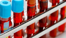 Những điều không thể bỏ qua với những người mang máu O