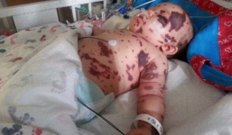 Nhiễm trùng máu - 'kẻ giết người thầm lặng' mọi bà mẹ nên nắm được triệu chứng sớm vì rất dễ bị chẩn đoán nhầm