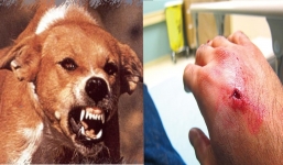13 người đi viện vì bị chó hoang tấn công bất ngờ