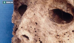 Xác ướp 450 tuổi hé lộ bí ẩn căn bệnh đáng sợ trong quá khứ