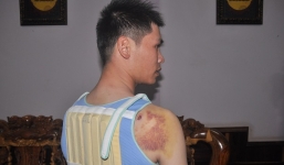 Khởi tố con trai bí thư xã bắn người nhập viện