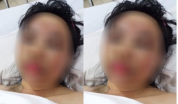 Mẹ chồng tạt axit con dâu được phát hiện chết tại nhà riêng