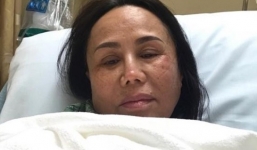 Xót xa danh ca Thanh Tuyền tiều tụy vì gặp tai nạn nghiêm trọng