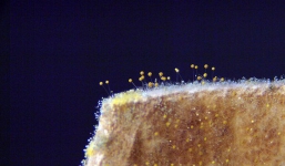 'Thủ phạm' bất ngờ gây ung thư gan: Chuyên gia cảnh báo nếu lỡ ăn vào không thể thải độc