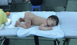 Mẹ tưởng con chỉ bị viêm phổi nhưng cuối cùng lại mắc bệnh lạ nguy hiểm