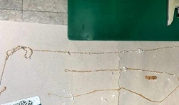 Ăn sushi triền miên tháng ngày, người đàn ông tá hỏa khi phát hiện con sán dây dài 167cm trong bụng