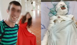 Không đồng ý làm bạn gái, người phụ nữ bị gã trai ngoại quốc tẩm xăng thiêu sống