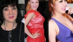 Dàn mỹ nhân Việt tụt dốc nhan sắc thảm họa vì phẫu thuật thẩm mỹ