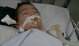 Bé gái 8 tháng bị tiêm nhầm kali có dấu hiệu chết não