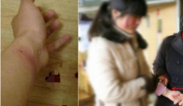 Bị thầy giáo xâm hại nhiều lần, nữ sinh lớp 12 cắt cổ tay tự tử