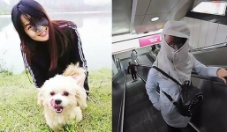 Bị vết chàm lớn bẩm sinh, cô gái phải biến gương mặt thành 'trái bầu' để chữa bệnh bất chấp nhiều người chê cười