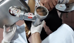 Bé 5 tuổi bị nát nhừ bàn tay vì máy xay thịt