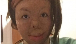 Le lói ánh sáng trong cuộc sống của 9x bị chồng tẩm xăng đốt dịp Tết