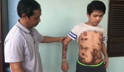 Cậu bé 16 tuổi sống sót sau vụ cháy xưởng bánh kẹo khiến 8 người tử vong ở Hà Nội bây giờ ra sao