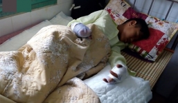 Nam thanh niên chơi pháo ngày Tết bị nổ dập nát cả 2 bàn tay