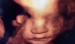 Xem tấm hình chụp thai nhi 6 tuần tuổi, người mẹ bất ngờ khi thấy hành động của đứa con trong bụng