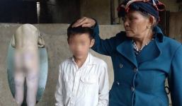 Con trai bị bố dượng đánh nhập viện vì nghi trộm tiền của hàng xóm