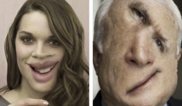 Người phụ nữ nhìn ai cũng ra quái vật do mắc chứng bệnh kỳ lạ