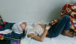 Tưới xăng thiêu sống con, cháu ruột vì nhuộm tóc đỏ