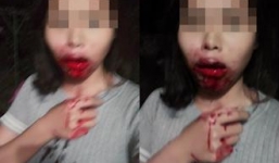 Chồng đánh vợ chảy máu mồm vì bật đèn đi vệ sinh trong đêm