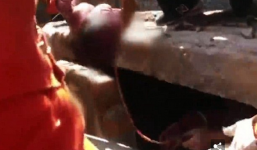 Đẻ rơi con ở toilet rồi tiếp tục đi khám thai vì tưởng chỉ bị đau dạ dày