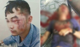 Cho bạn vay tiền xây nhà, đến khi cần đòi lại bị chém trọng thương