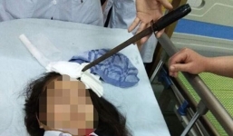 Vụ nữ sinh bị bạn học phi dao trúng đầu: Bộ GDĐT chỉ đạo “nóng” 