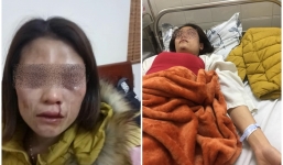 Chồng cặp bồ, đánh vợ đến nhập viện đúng dịp 8/3