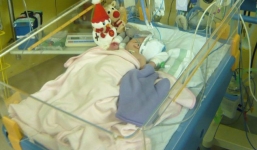 Bác sĩ nghĩ bé sơ sinh bị bầm tím nhưng 2 tuần sau, kết luận của họ khiến bố mẹ lo sợ