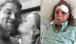 Sự thật phía sau tấm ảnh hạnh phúc của cặp đôi: Gã bạn trai độc ác kêu bạn hãm hiếp và đánh bạn gái mình tàn nhẫn