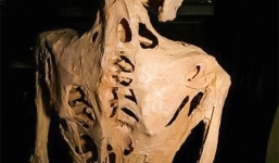 7 căn bệnh lạ lỡ mắc phải chỉ có phát khóc bởi bác sĩ cũng phải 'bó tay'