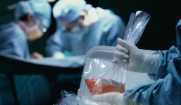 Muốn hiến tạng phải tự trả tiền xét nghiệm: Vô lý và thiếu nhân văn