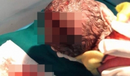 Tự sinh con, tự đỡ đẻ tại nhà gây nguy hiểm tính mạng: Có thể bị xử lý hình sự về tội Vô ý làm chết người theo quy định của pháp luật