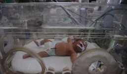 Hàng loạt trẻ sơ sinh gãy xương, nứt sọ nghi do y tá đánh đập dã man