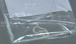 Gắp sán dài 13 cm ra khỏi ngực một phụ nữ