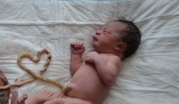 Bộ Y tế nói gì vụ mẹ con sản phụ tử vong vì sinh “thuận tự nhiên”?