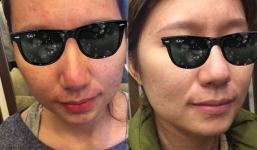 Tâm sự của cô gái từng đi xin việc 3 nơi đều bị từ chối vì mặt mụn